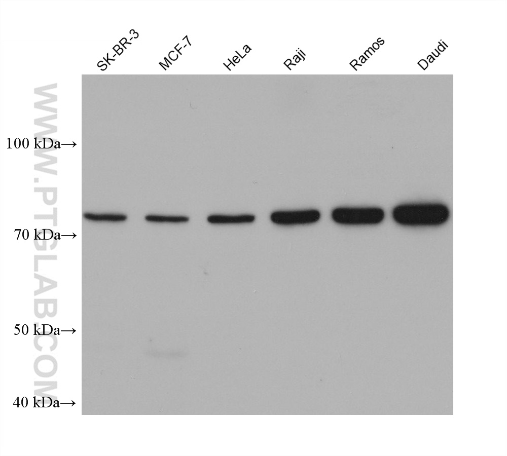 WB analysis using 68531-1-Ig