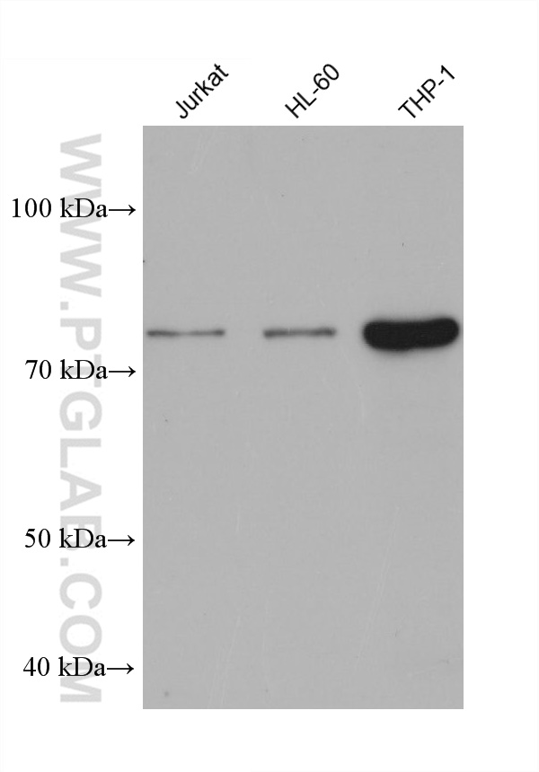 WB analysis using 68531-1-Ig