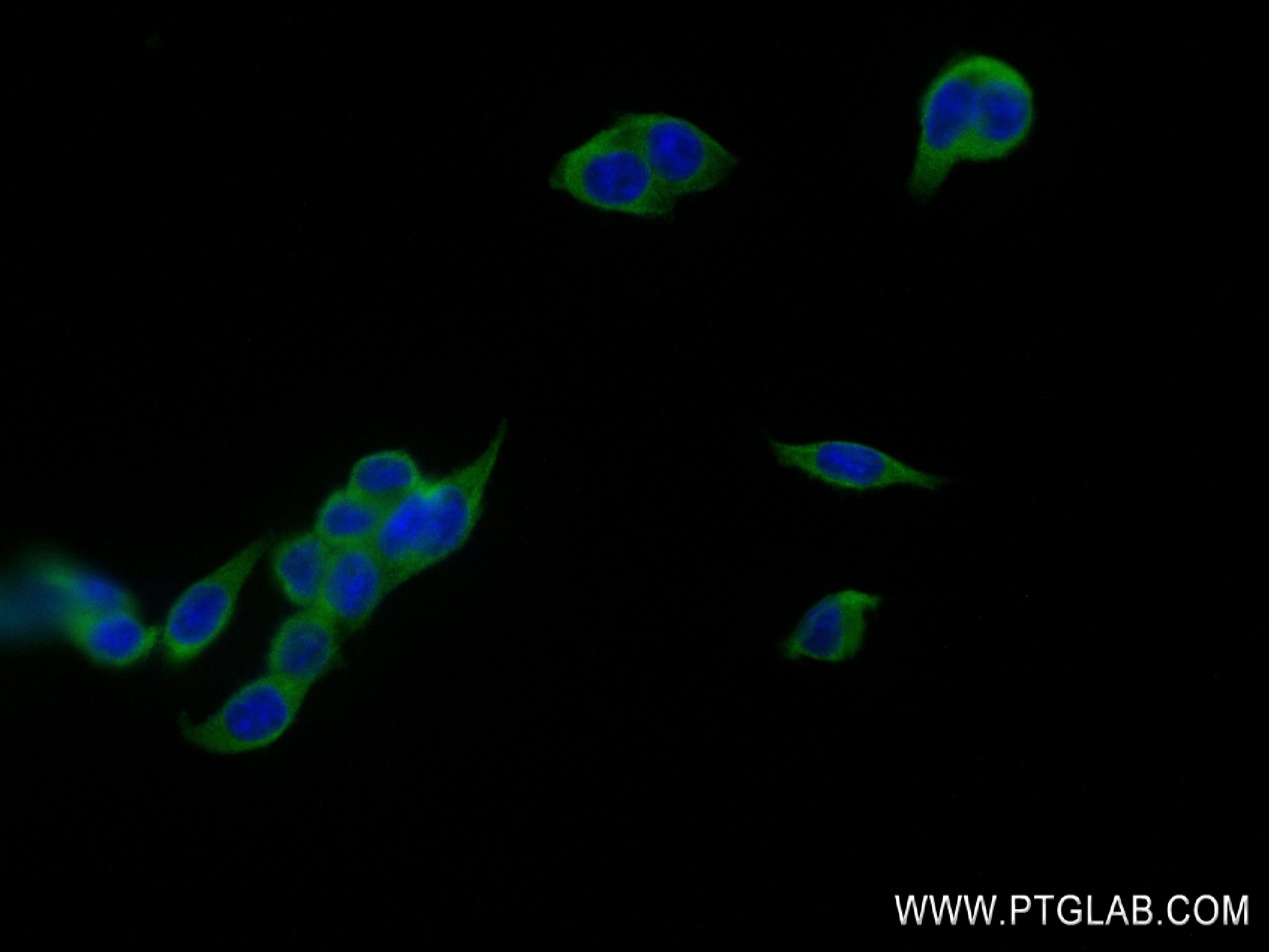 IF Staining of HCT 116 using 84372-5-RR (same clone as 84372-5-PBS)