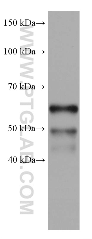 WB analysis of pig thymus using 66966-1-Ig (same clone as 66966-1-PBS)