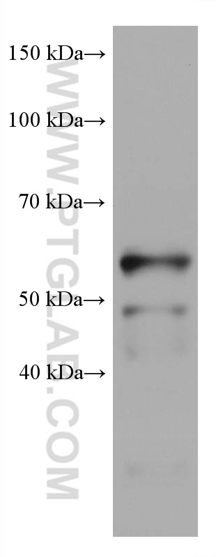 WB analysis of rabbit spleen using 66966-1-Ig (same clone as 66966-1-PBS)