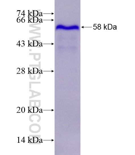 IKZF1 fusion protein Ag28637 SDS-PAGE