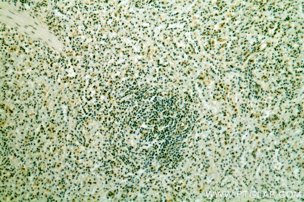 IHC staining of human spleen using 19055-1-AP