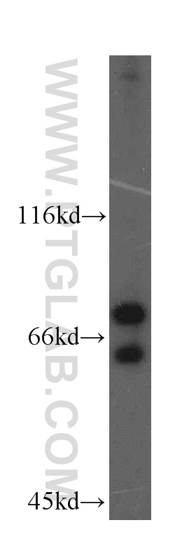 WB analysis of HepG2 using 19055-1-AP