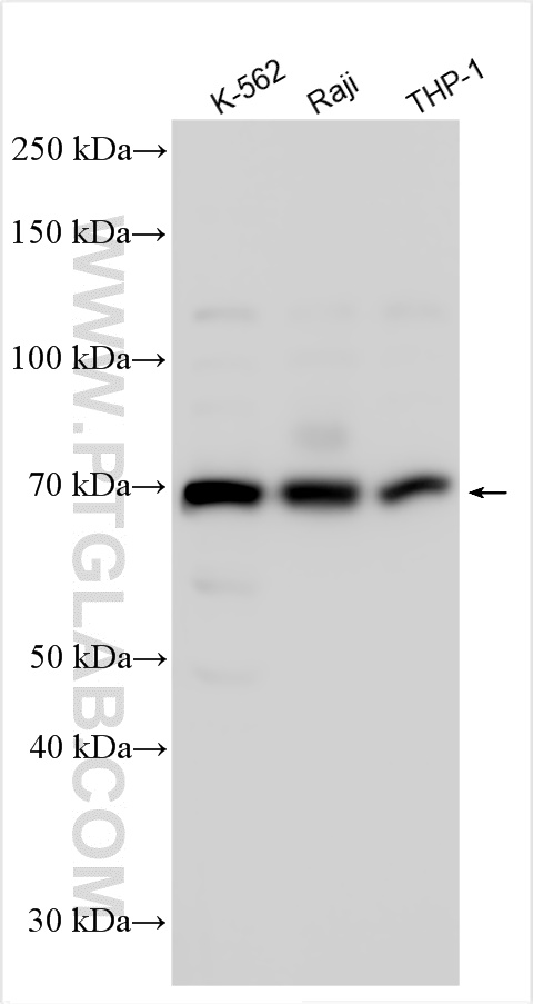 WB analysis using 31094-1-AP