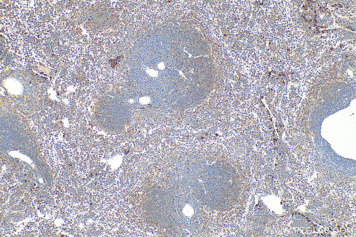 IHC staining of mouse spleen using 27348-1-AP