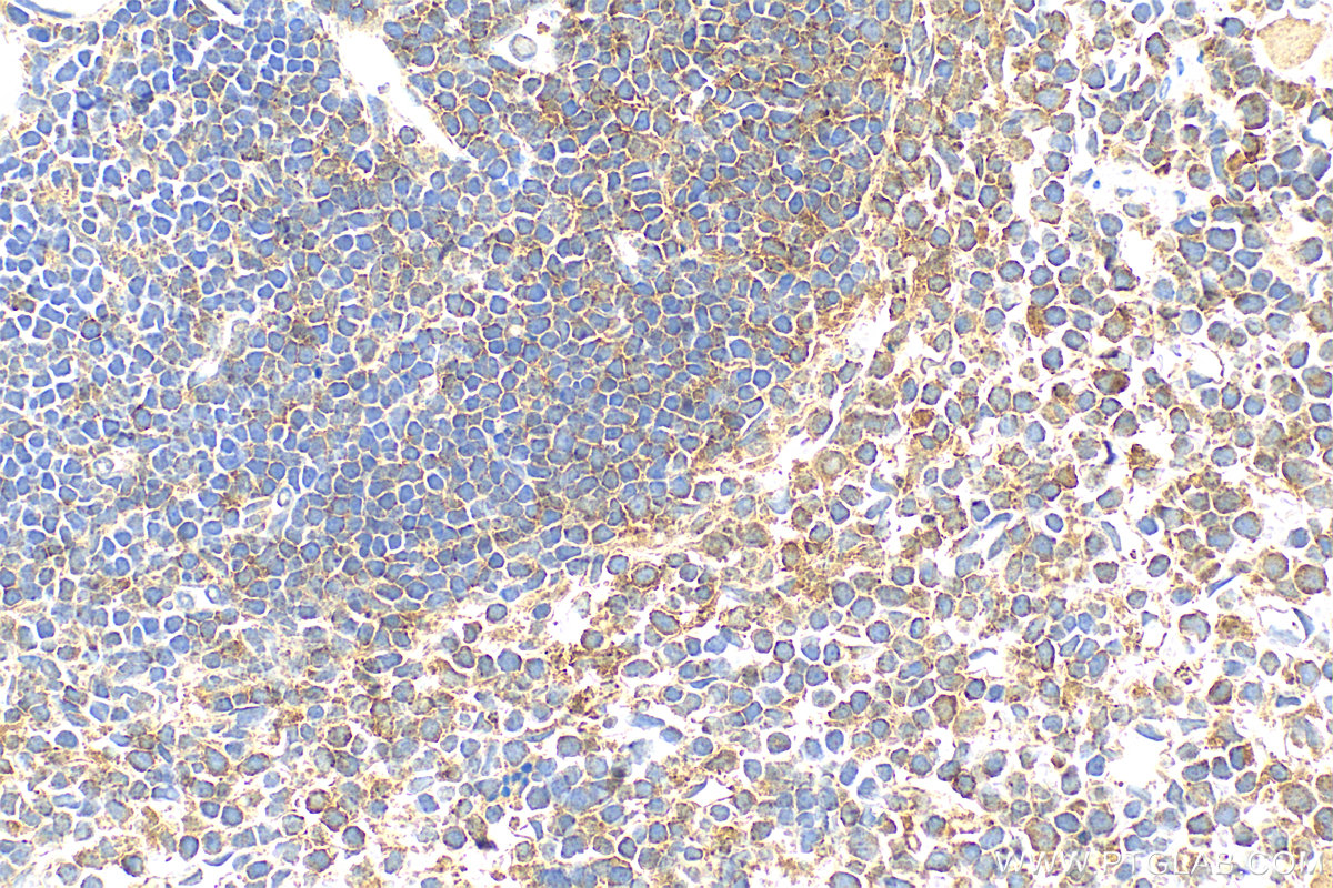 IHC staining of mouse spleen using 27348-1-AP