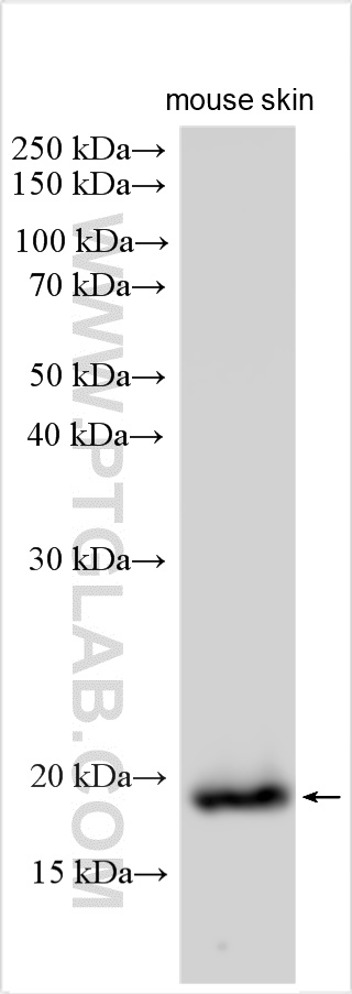 WB analysis using 31127-1-AP