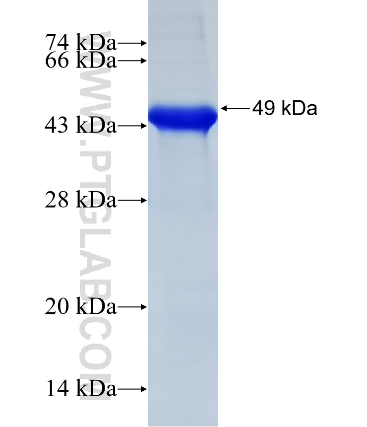 IL-21R fusion protein Ag31764 SDS-PAGE