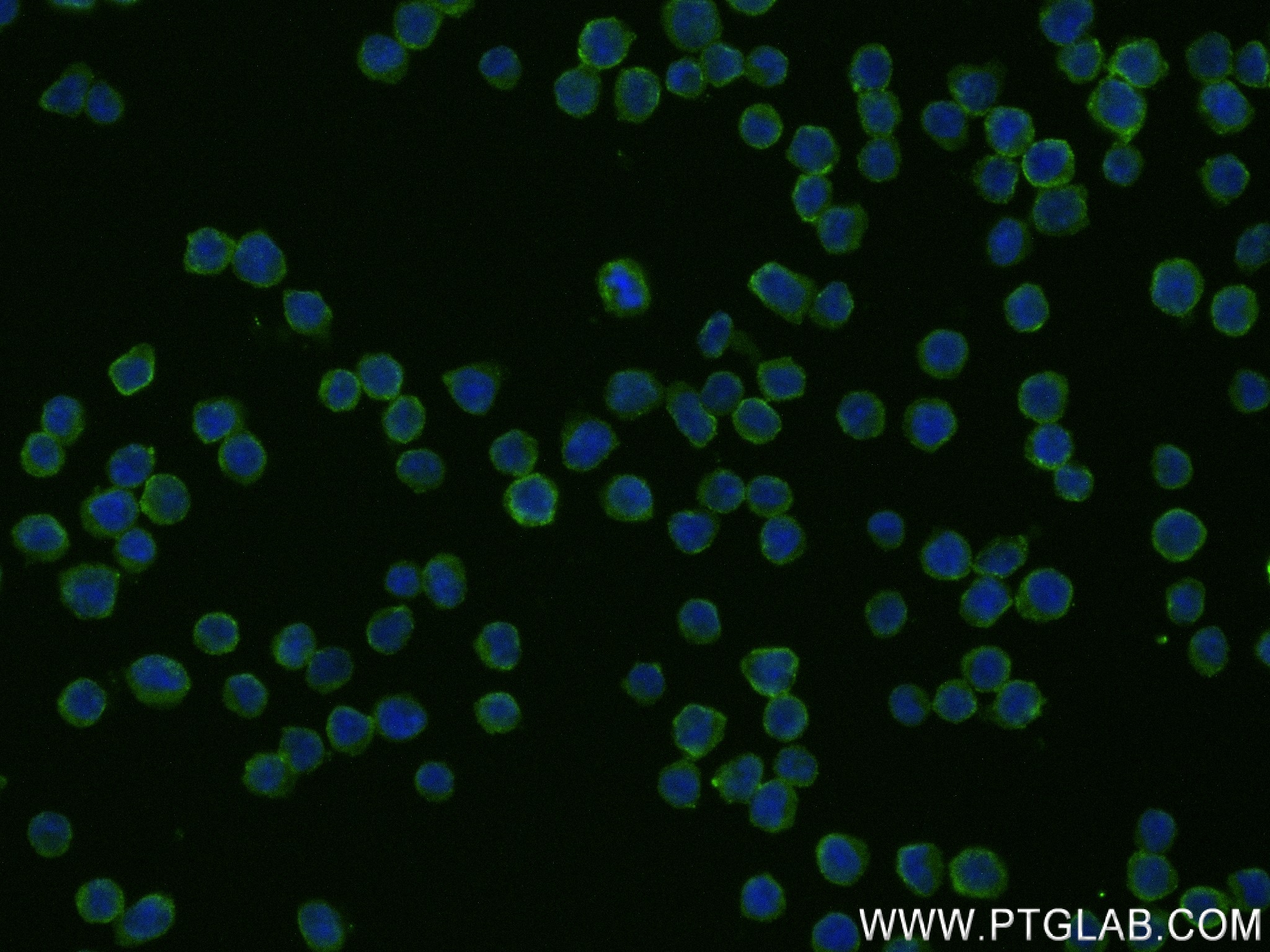 IF Staining of Ramos using 83894-1-RR (same clone as 83894-1-PBS)