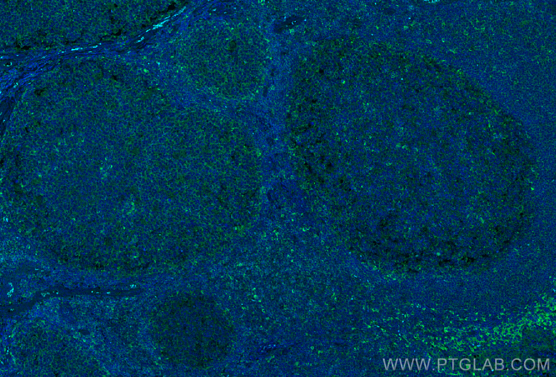 IF Staining of human tonsillitis using CL488-67051