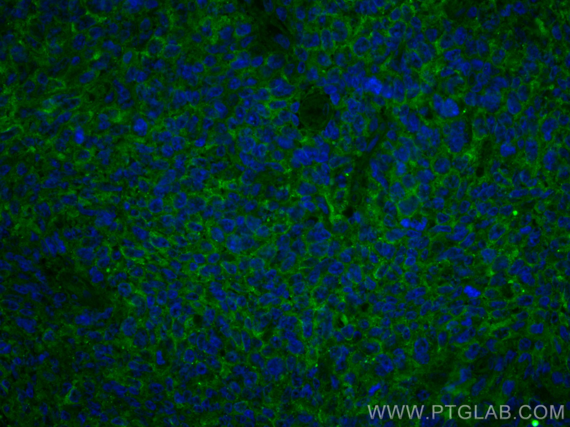 IF Staining of human tonsillitis using CL488-66144