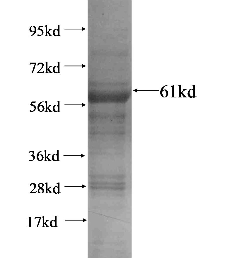 IL-13RA2 fusion protein Ag1534 SDS-PAGE