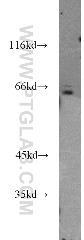 WB analysis of HeLa using 16744-1-AP