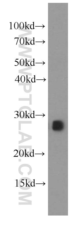 IL-17D Monoclonal antibody