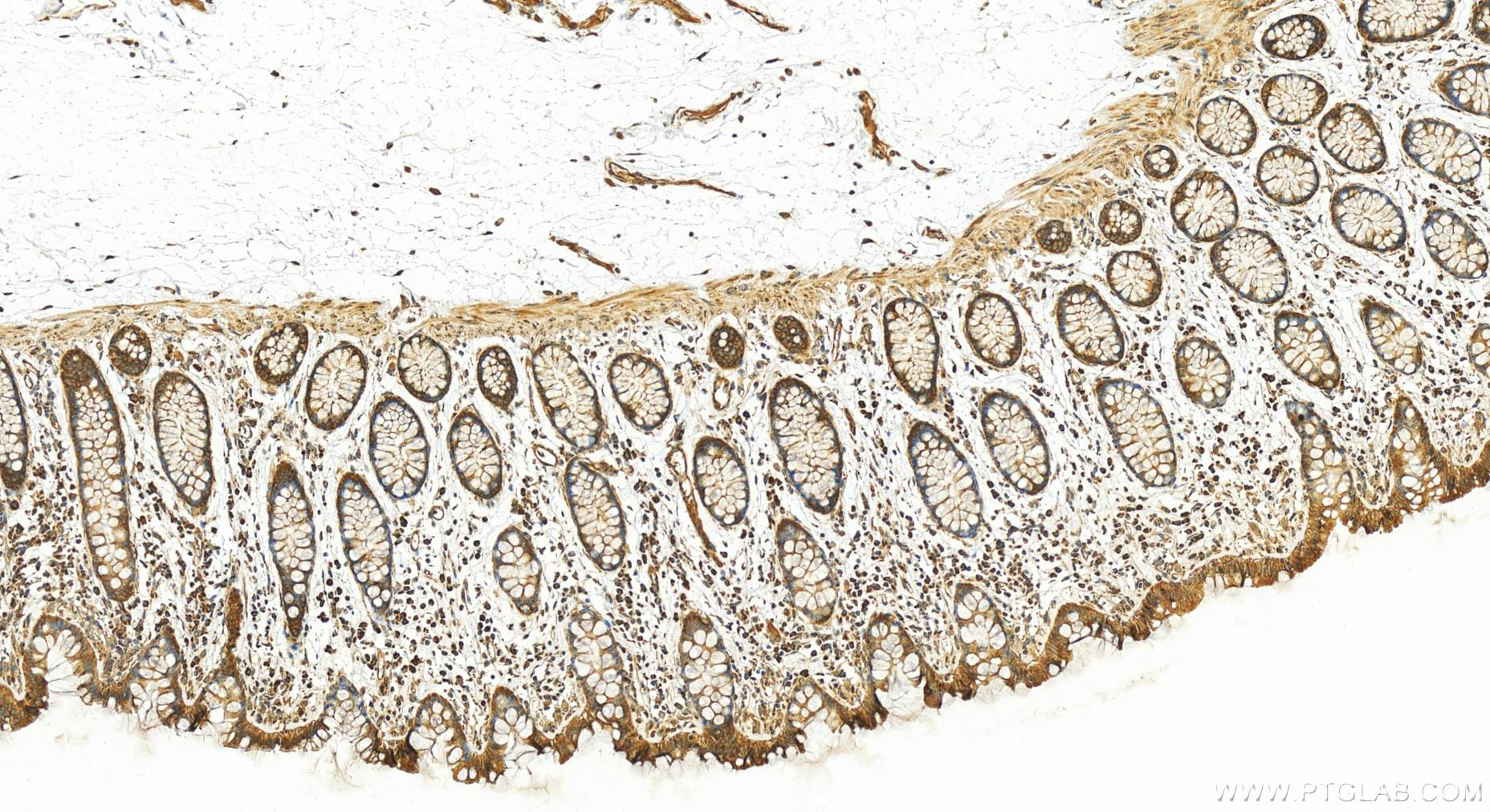 IHC staining of human colon using 20673-1-AP