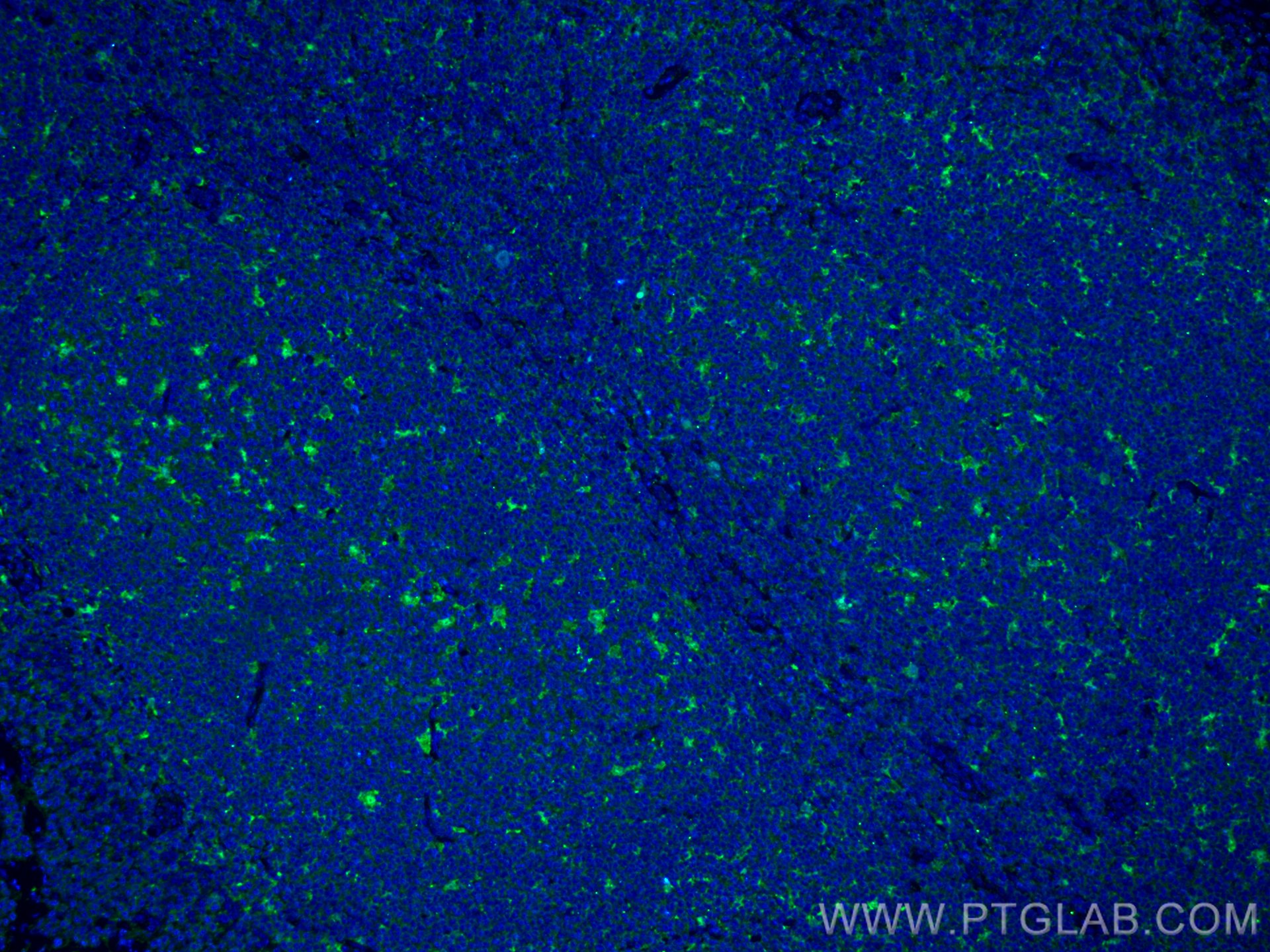 IF Staining of human tonsillitis using 60070-1-Ig (same clone as 60070-1-PBS)