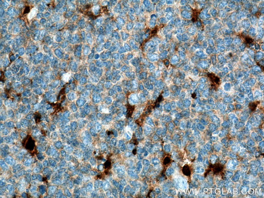 IHC staining of human tonsillitis using 60070-1-Ig (same clone as 60070-1-PBS)