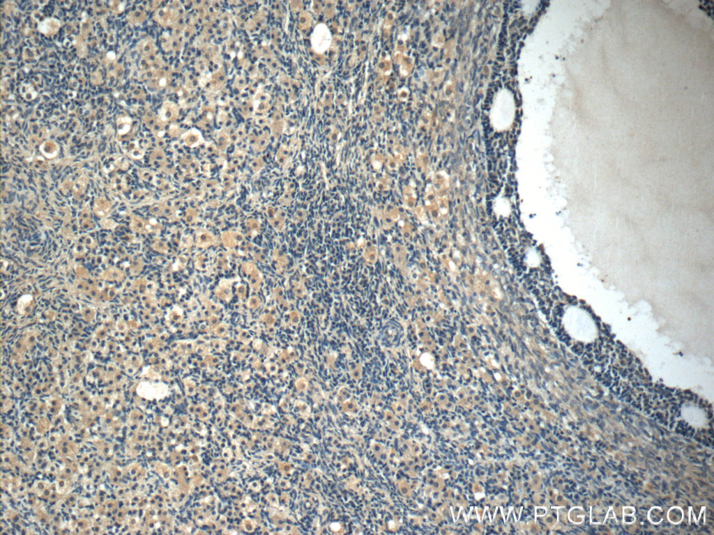 IHC staining of human ovary using 60248-1-Ig