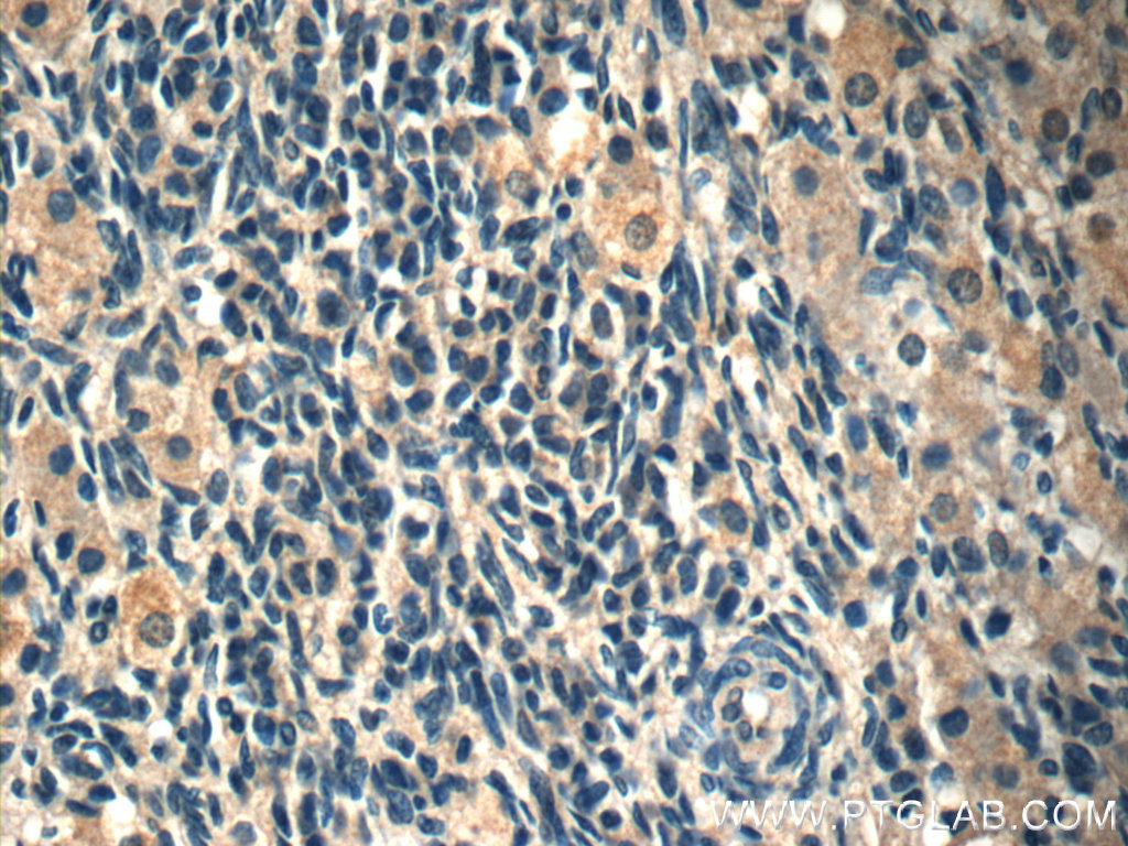 IHC staining of human ovary using 60248-1-Ig