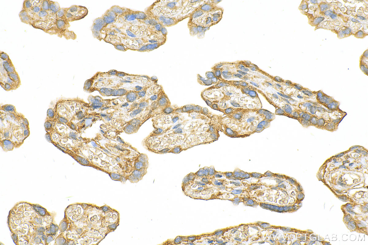 IHC staining of human placenta using 30966-1-AP