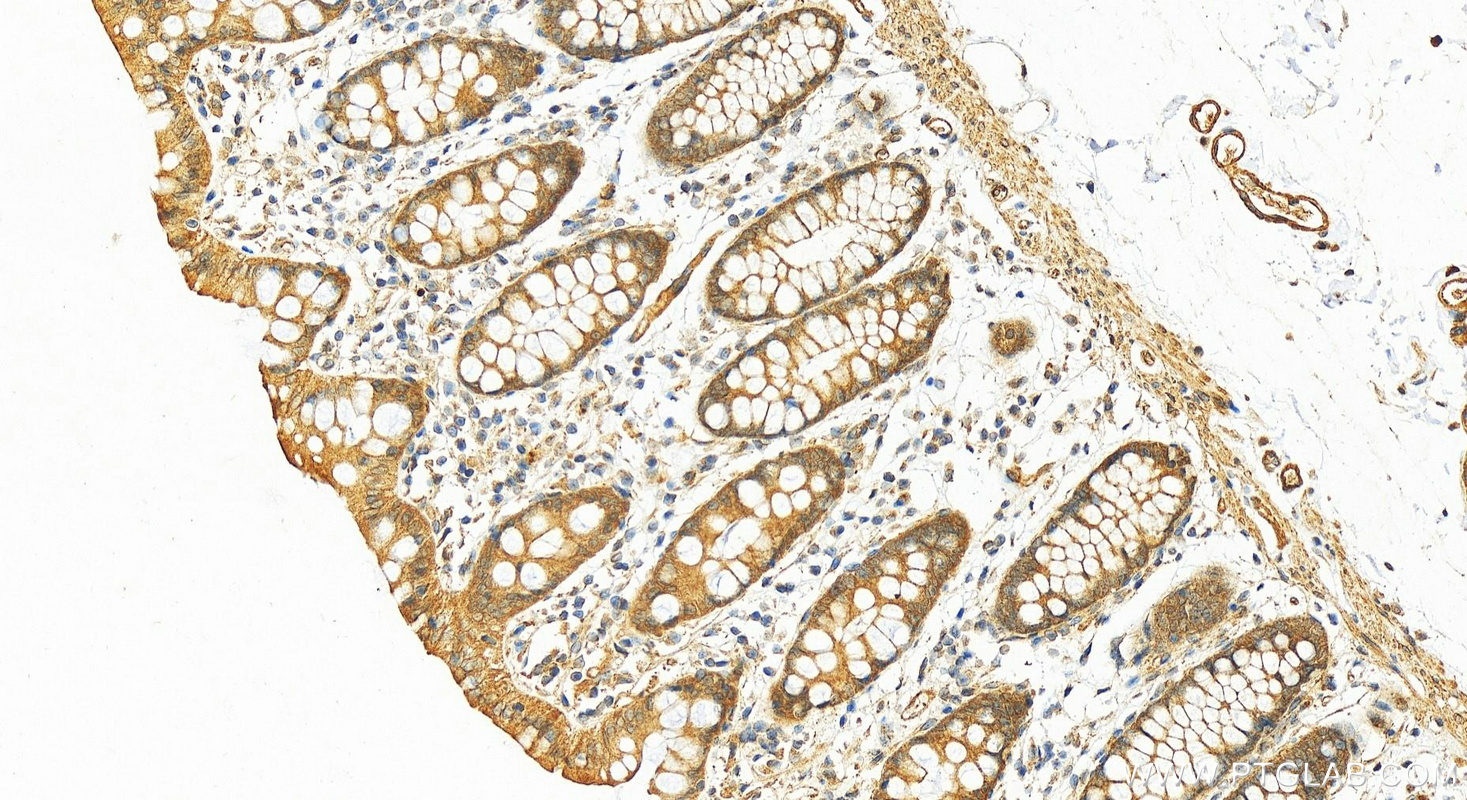 IHC staining of human colon using 10844-1-AP