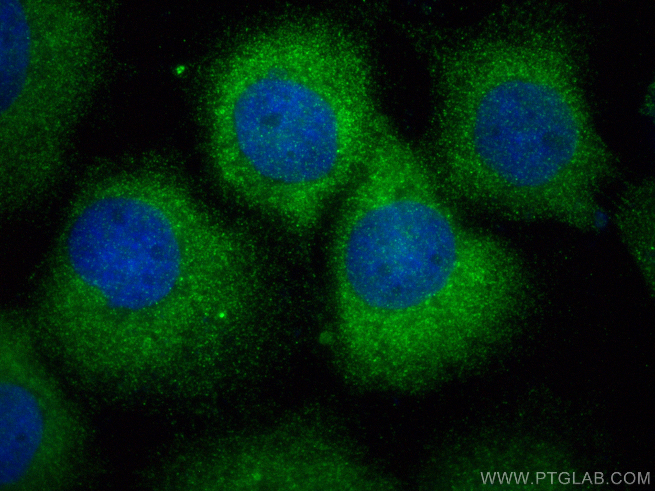 IF Staining of A431 using 10844-1-AP