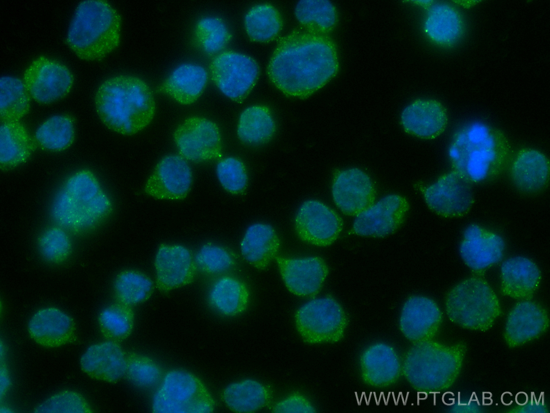 IF Staining of Jurkat using 60306-1-Ig (same clone as 60306-1-PBS)