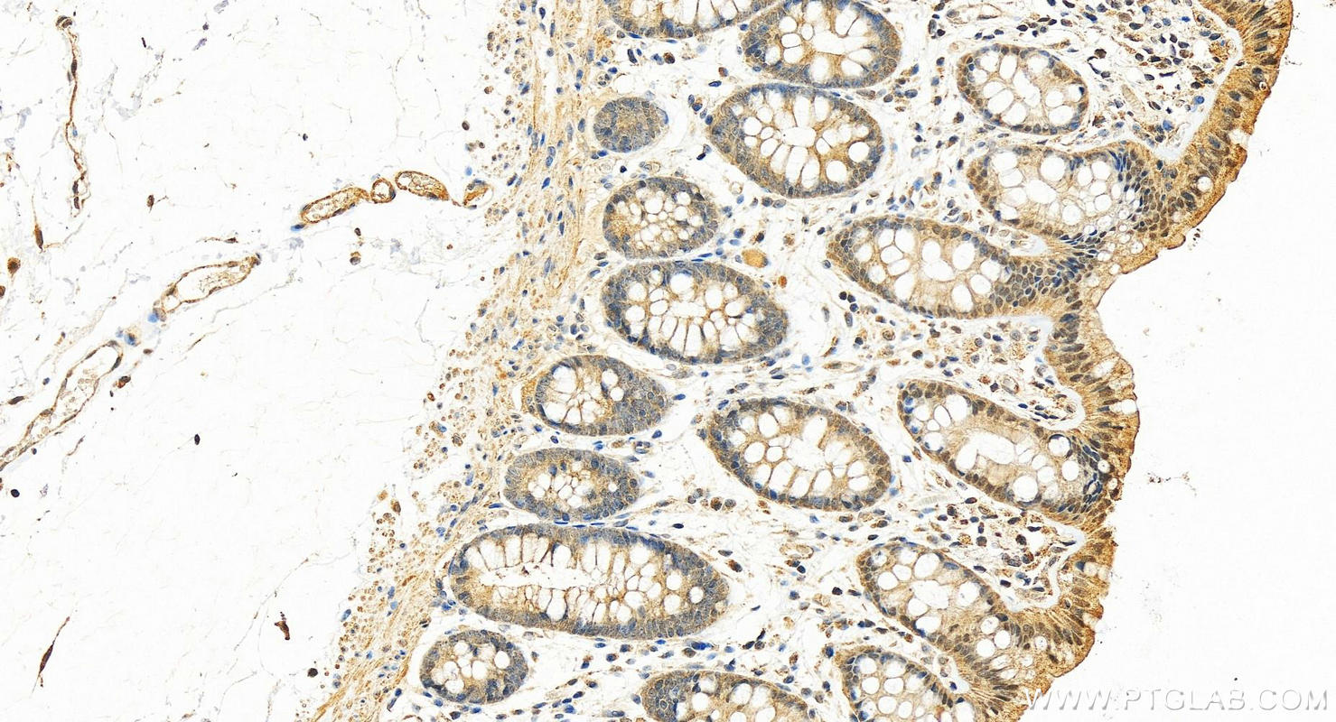 IHC staining of human colon using 26772-1-AP