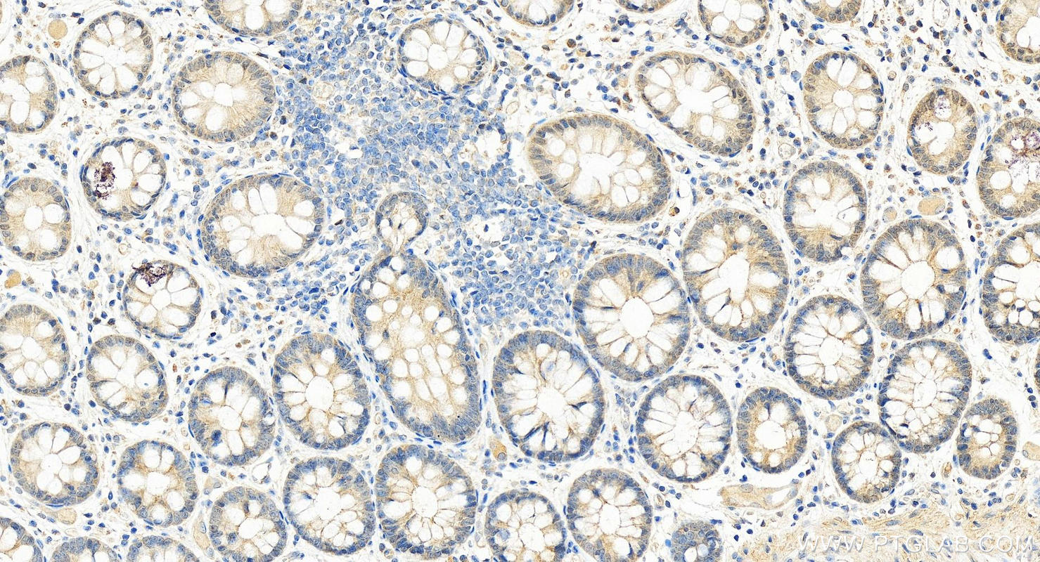 IHC staining of human colon using 26772-1-AP