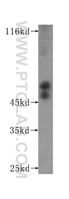 WB analysis of Recombinant protein using 60174-2-Ig (same clone as 60174-2-PBS)