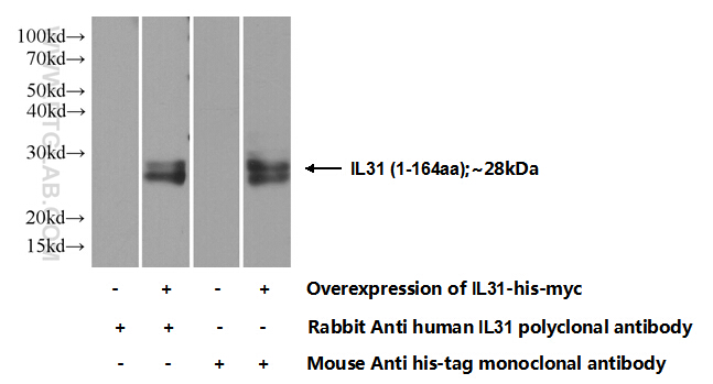 IL-31 Polyclonal antibody