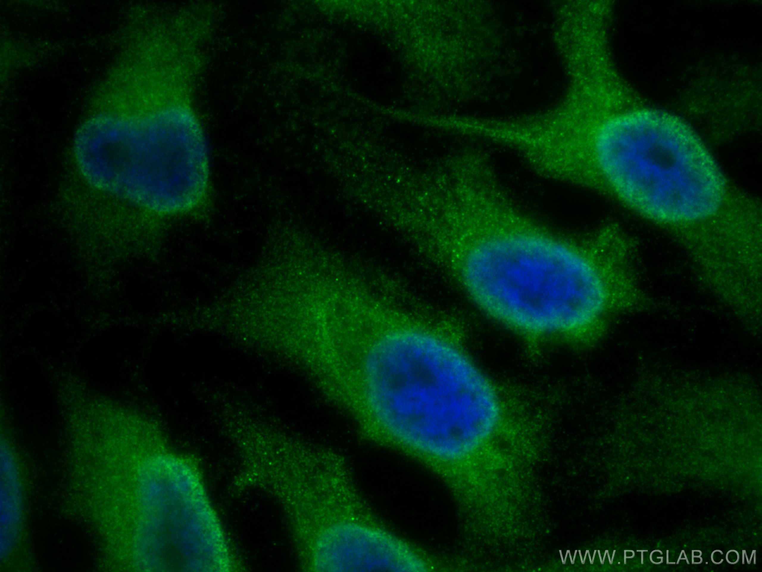 IF Staining of HeLa using 23048-1-AP