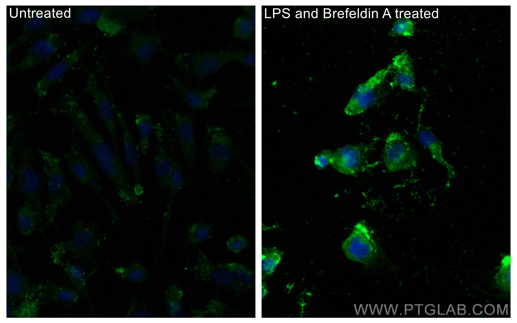 IF Staining of HUVEC using 21865-1-AP