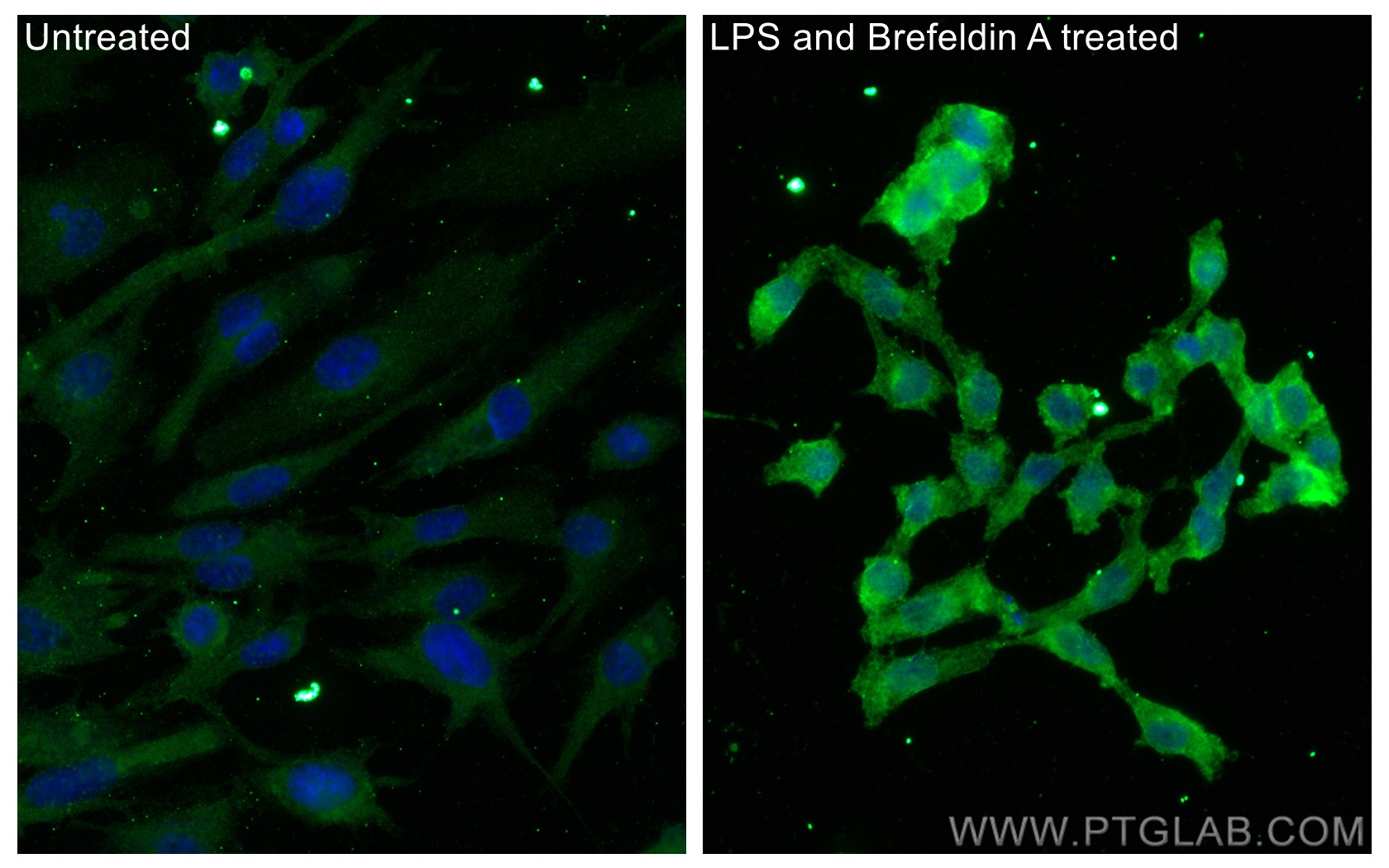 IF Staining of HUVEC using 66146-1-Ig (same clone as 66146-1-PBS)