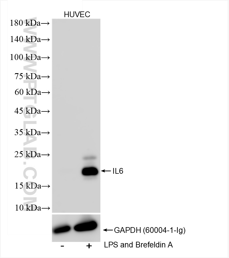 WB analysis of HUVEC using 83747-7-RR (same clone as 83747-7-PBS)