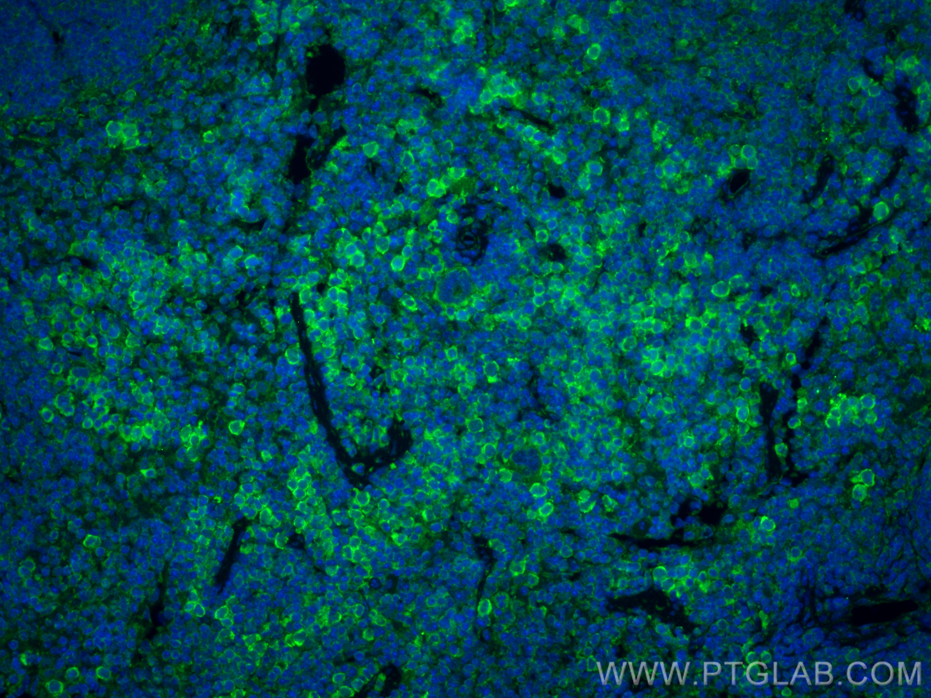 IF Staining of mouse spleen using 17626-1-AP