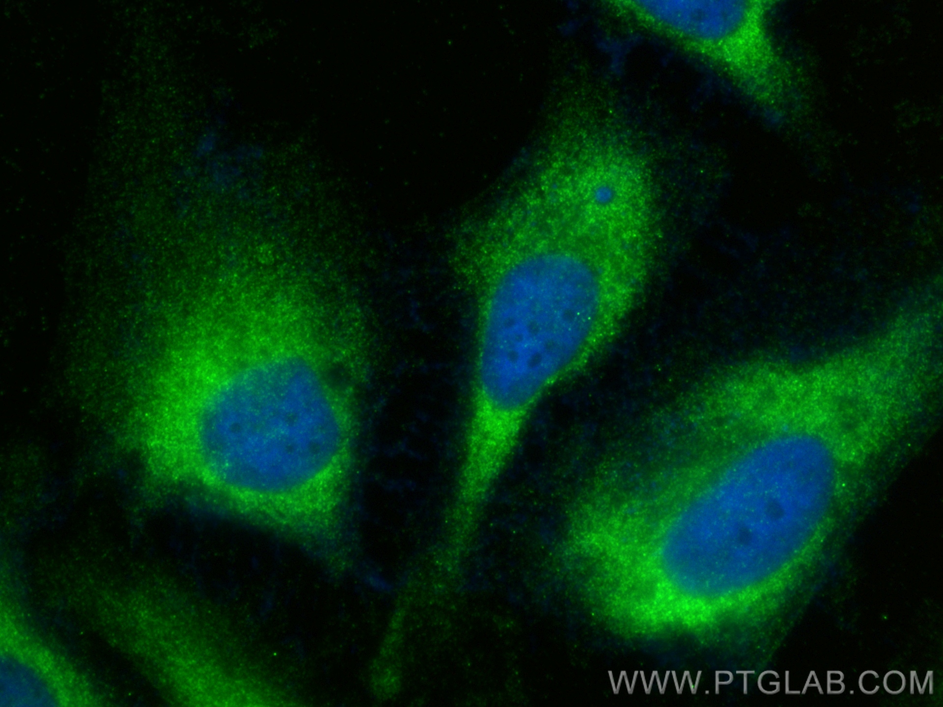 IF Staining of HeLa using 11220-1-AP