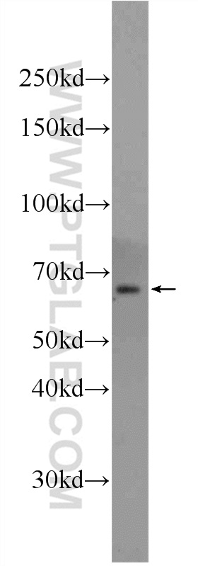 WB analysis of HepG2 using 24738-1-AP (same clone as 24738-1-PBS)