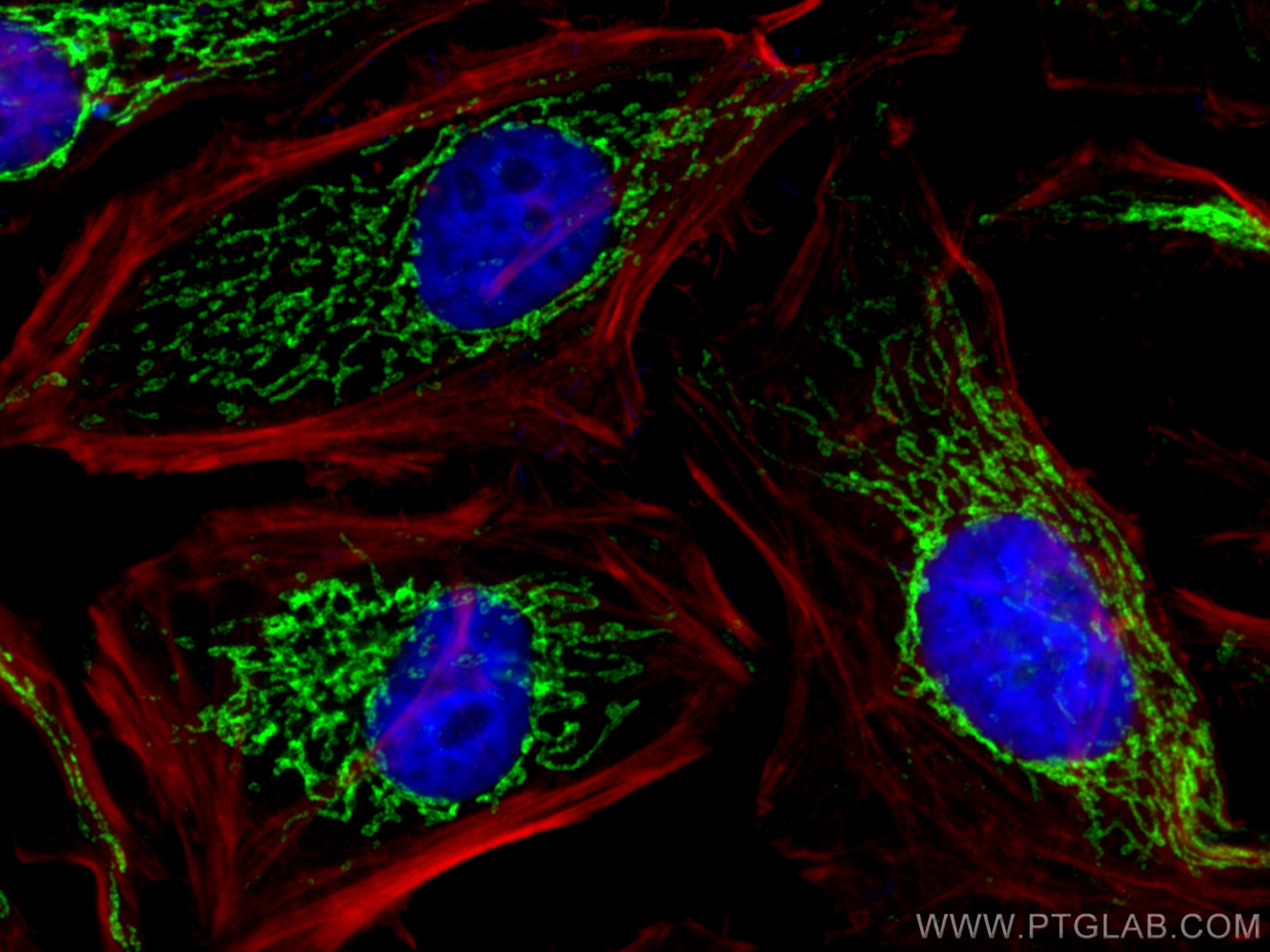 IF Staining of HeLa using 10179-1-AP