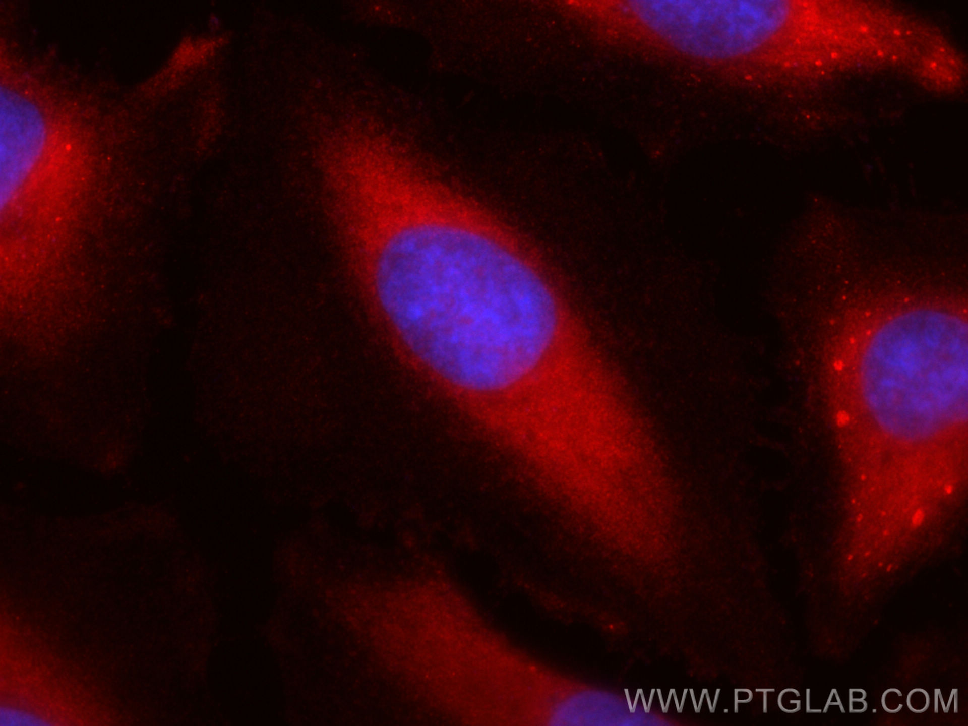 IF Staining of HeLa using CL594-12948