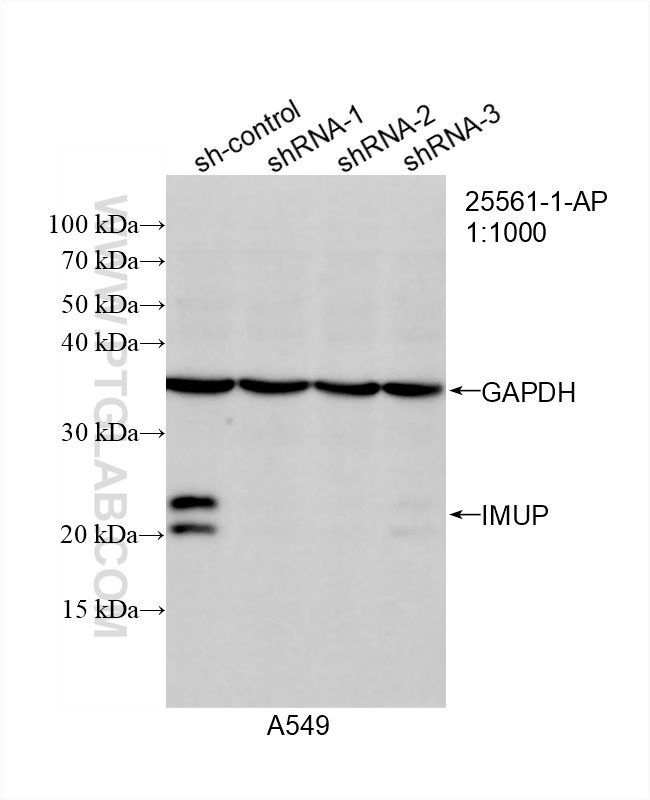 WB analysis of A549 using 25561-1-AP