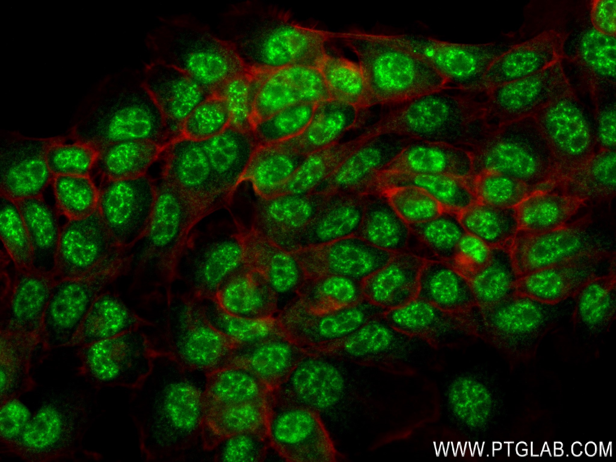 IF Staining of A431 using 84148-6-RR