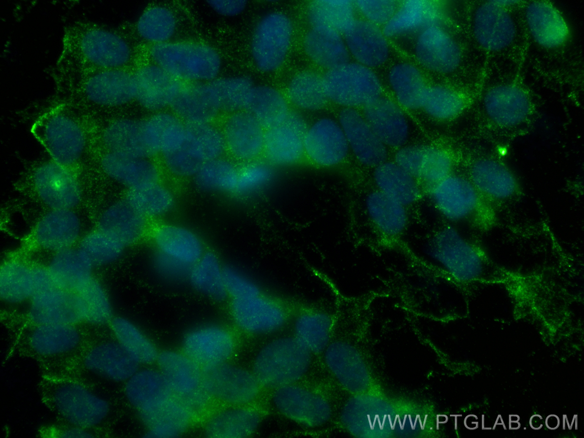 IF Staining of SH-SY5Y using 67120-1-Ig