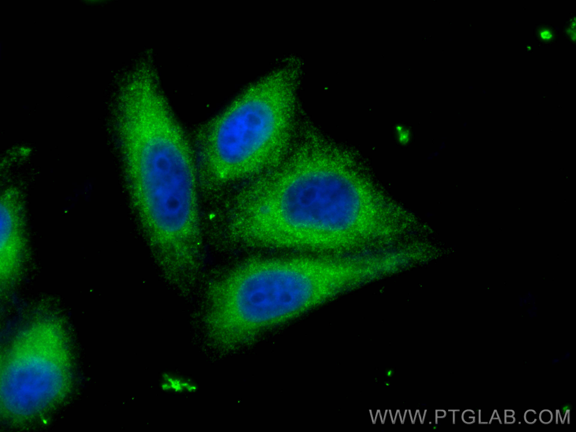 IF Staining of HepG2 using 20466-1-AP