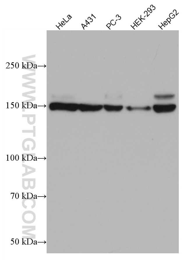 WB analysis using 66910-1-Ig