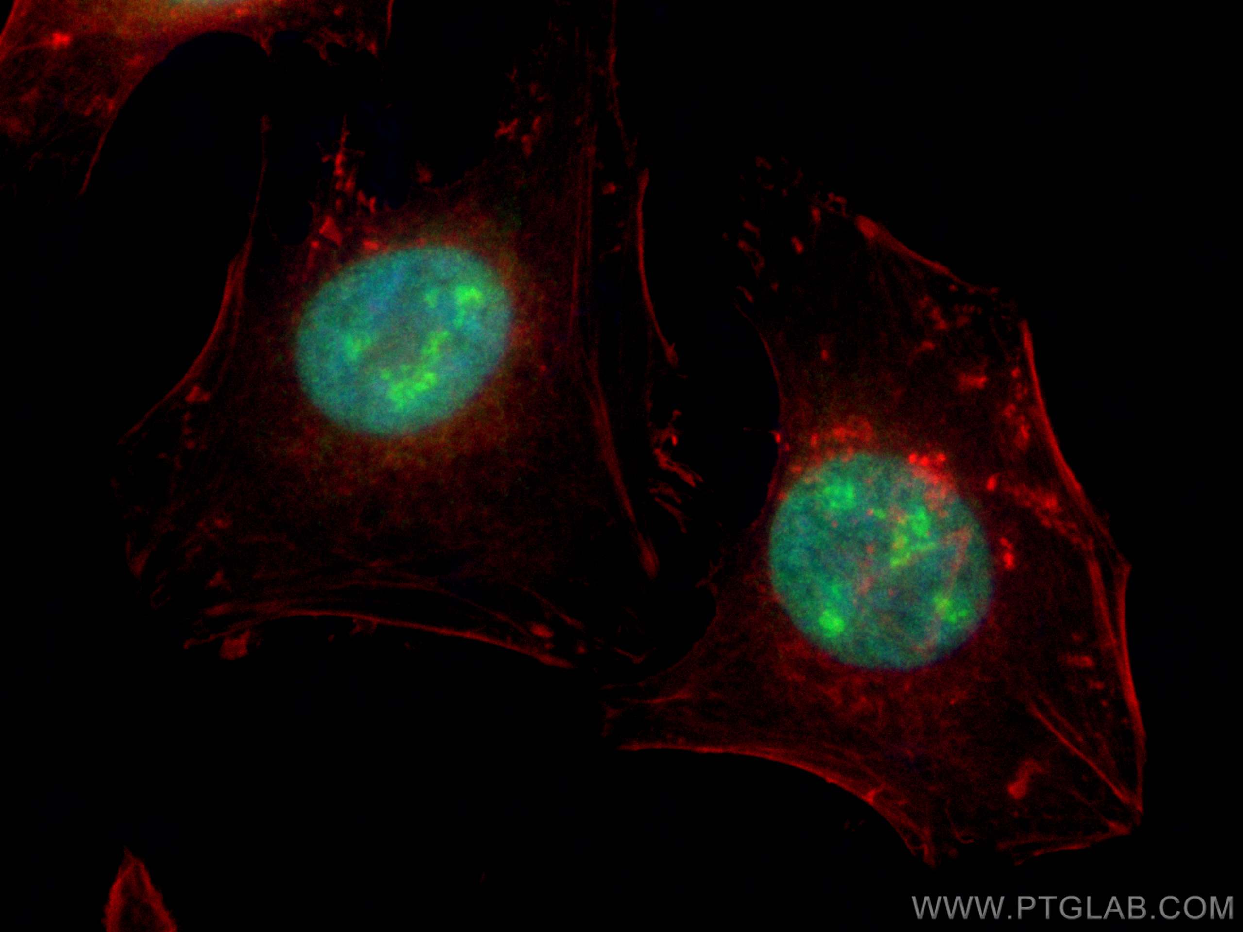 IF Staining of HeLa using 18810-1-AP