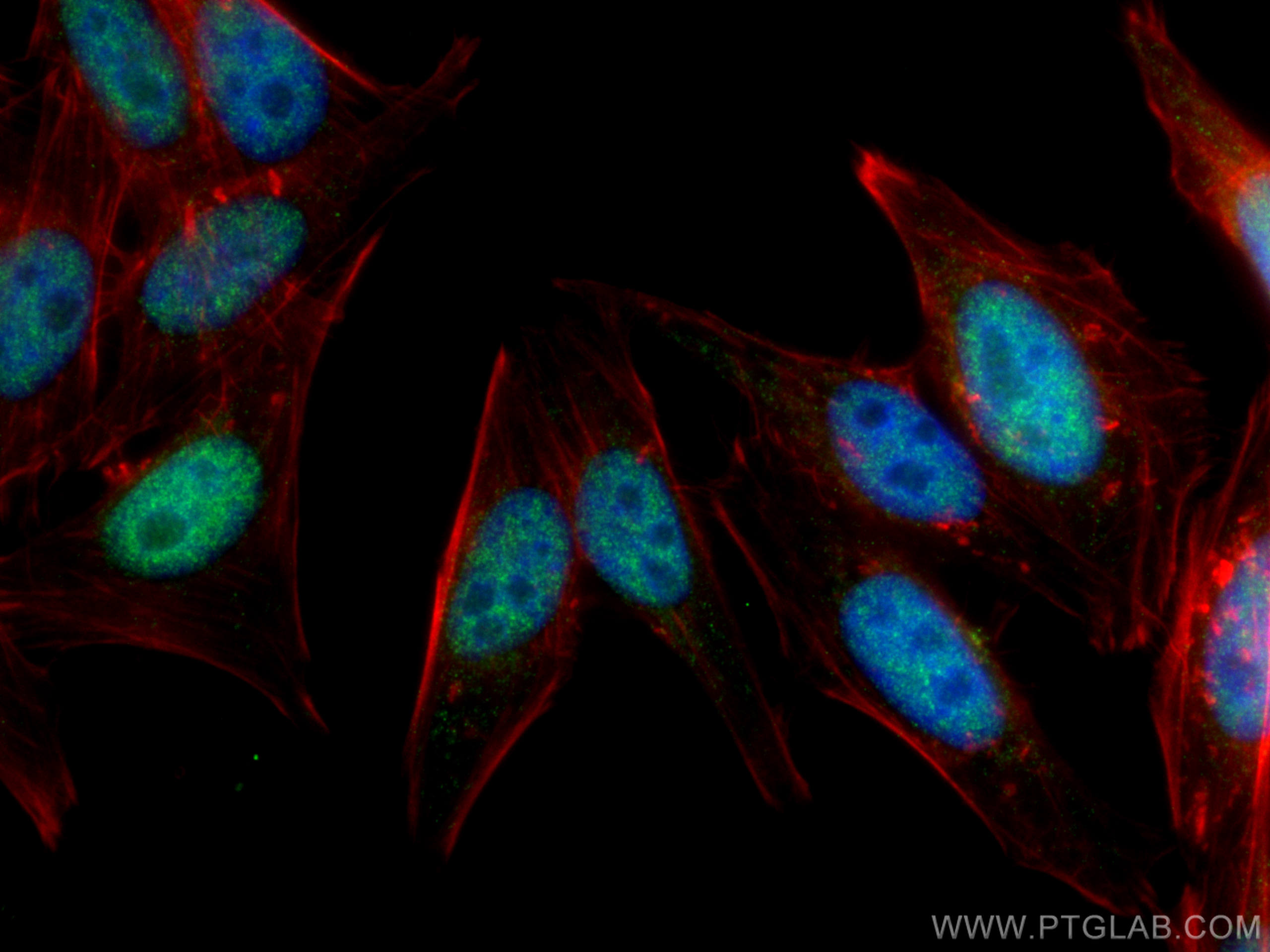 IF Staining of HepG2 using 29488-1-AP