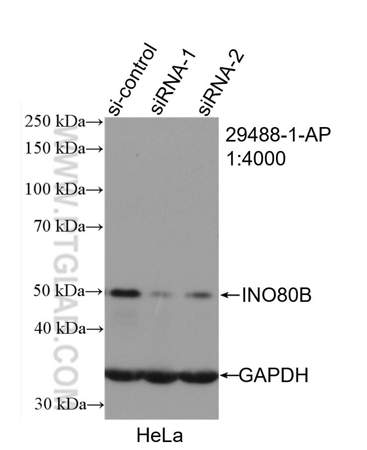 WB analysis of HeLa using 29488-1-AP