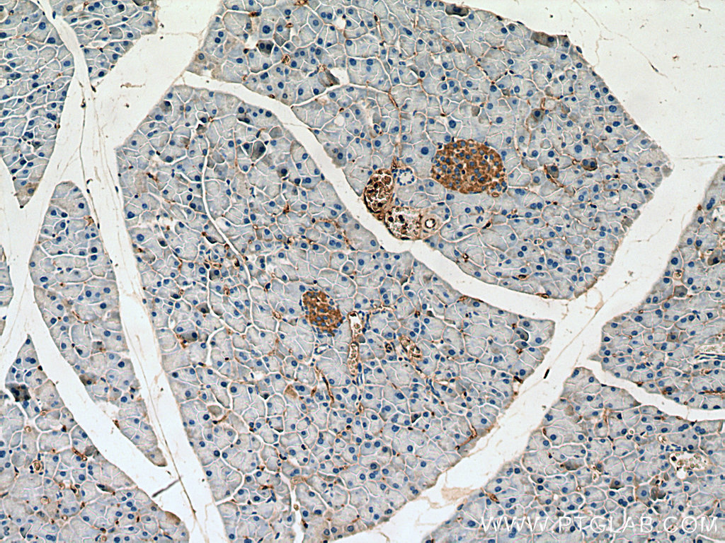 IHC staining of mouse pancreas using 15141-1-AP